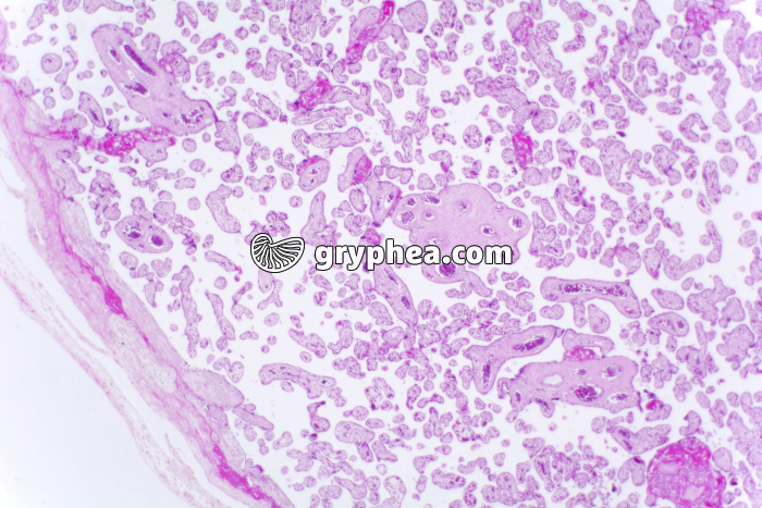 Placenta humain x40 - gryphea.org